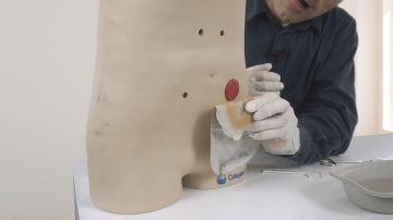 Einführung in die Stomapflege
